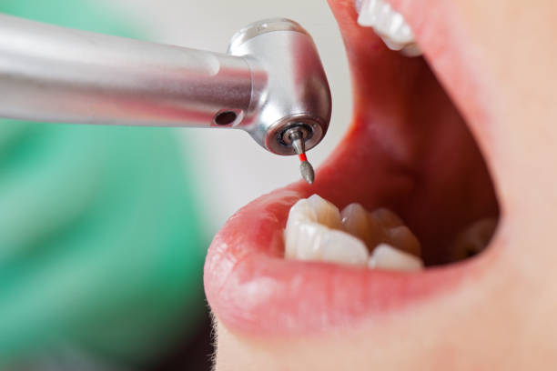 Best Emergency Treatment for Dental Infections or Abscesses in Kenvil, NJ
